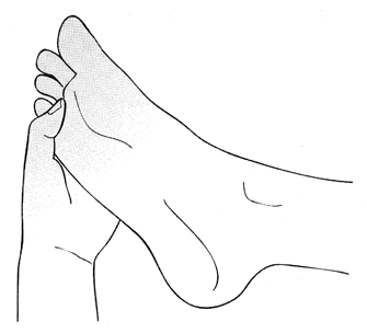 วิธีการนวดและกดจุดฝ่าเท้า บรรเทาอาการปวดศีรษะหรือเวียนศีรษะ