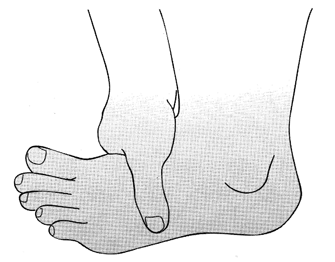 วิธีการนวดและกดจุดฝ่าเท้า บรรเทาอาการเจ็บหน้าอก