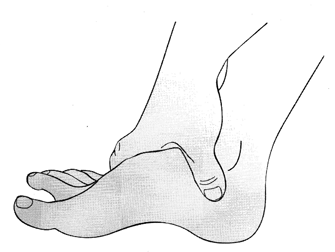 วิธีการนวดและกดจุดฝ่าเท้า บรรเทาและป้องกันอาการเป็นตะคริว