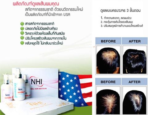 ʶҺѹ NHI-National Hair Institue Ǫҭԧͧ鹼˹ѧ